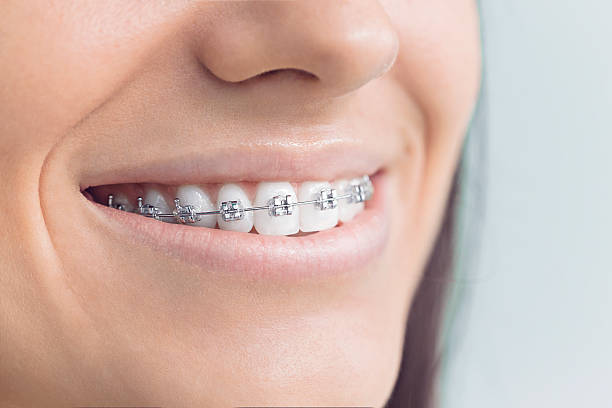 Best Invisalign and Clear Aligners  in Rolling Meadows, IL